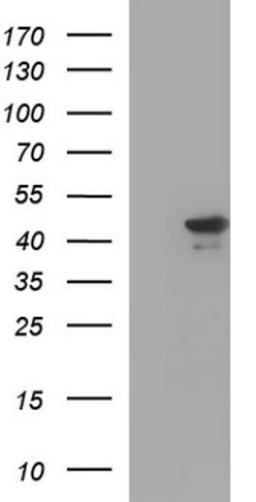 Western Blot: RPRD1B Antibody (1C9) [NBP2-45634] - Analysis of HEK293T cells were transfected with the pCMV6-ENTRY control (Left lane) or pCMV6-ENTRY RPRD1B.