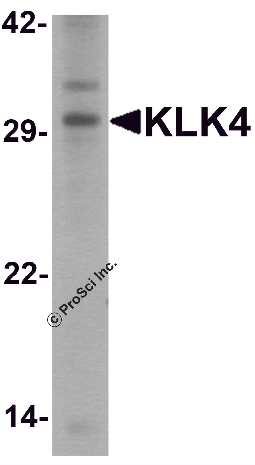 Western blot analysis of KLK4 in human kidney tissue lysate with KLK4 antibody at 1 &#956;g/ml.