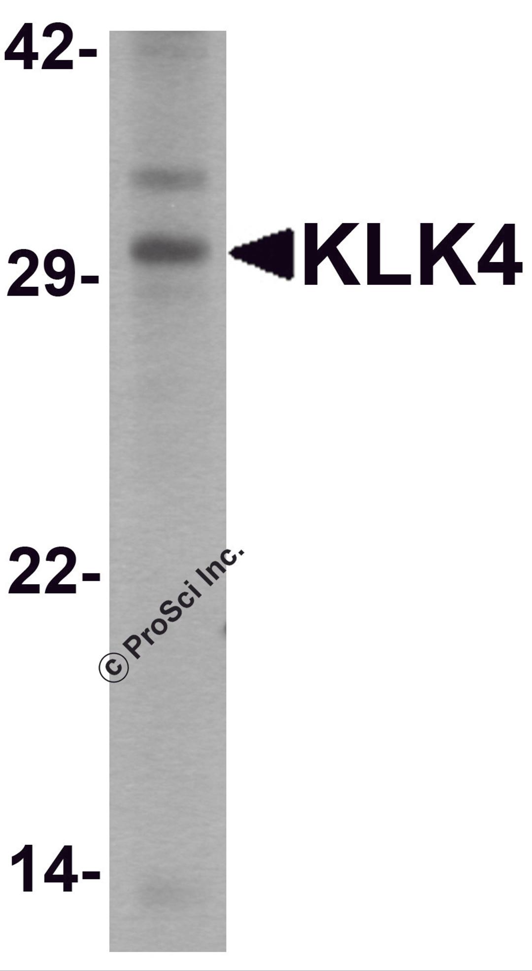 Western blot analysis of KLK4 in human kidney tissue lysate with KLK4 antibody at 1 μg/ml.