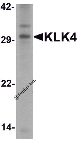Western blot analysis of KLK4 in human kidney tissue lysate with KLK4 antibody at 1 μg/ml.