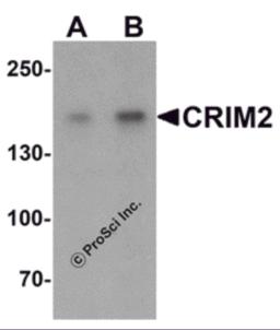 Western blot analysis of CRIM2 in Jurkat cell lysate with CRIM2 antibody at (A) 1 and (B) 2 &#956;g/mL.