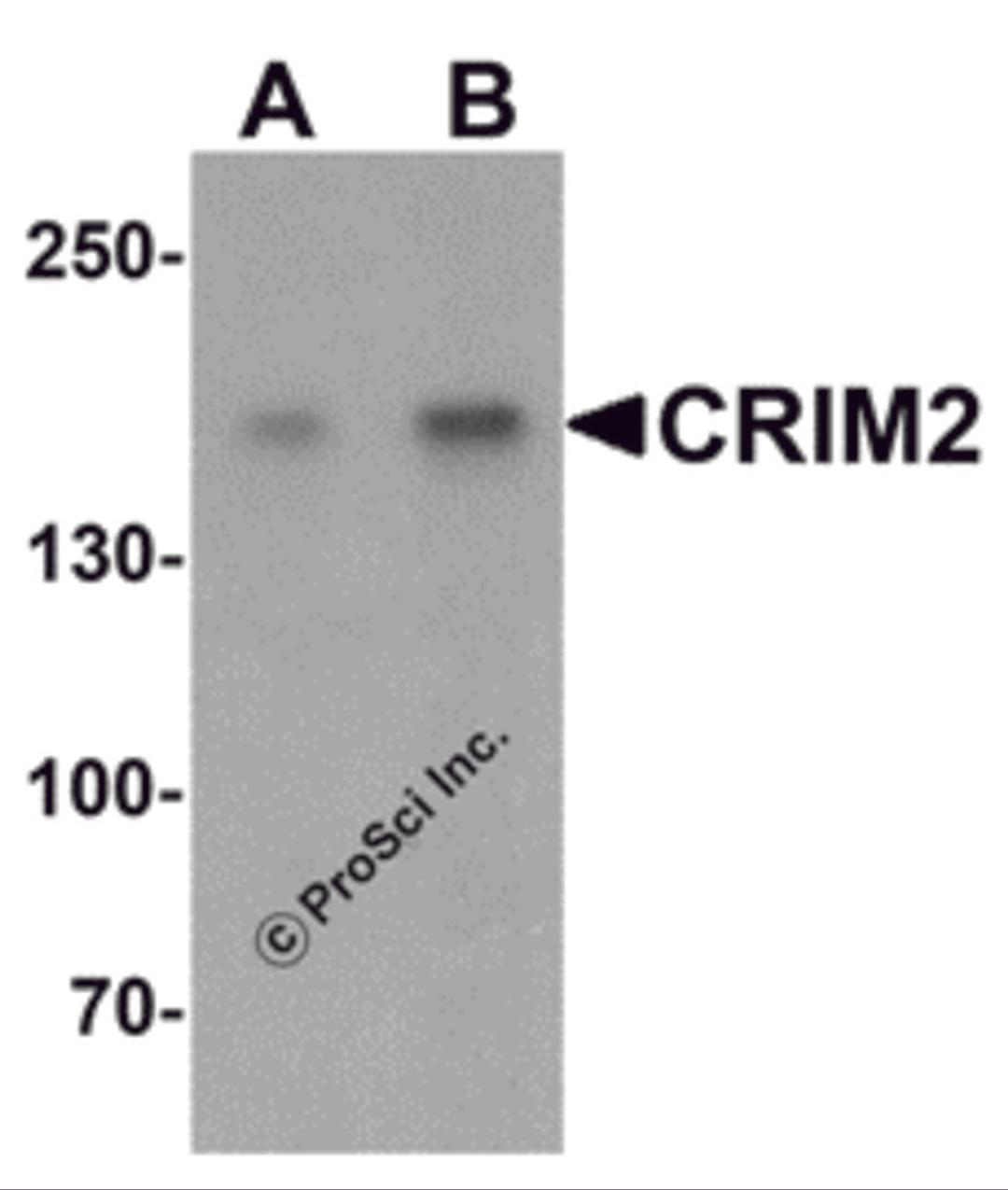 Western blot analysis of CRIM2 in Jurkat cell lysate with CRIM2 antibody at (A) 1 and (B) 2 μg/mL.