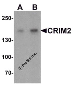 Western blot analysis of CRIM2 in Jurkat cell lysate with CRIM2 antibody at (A) 1 and (B) 2 μg/mL.