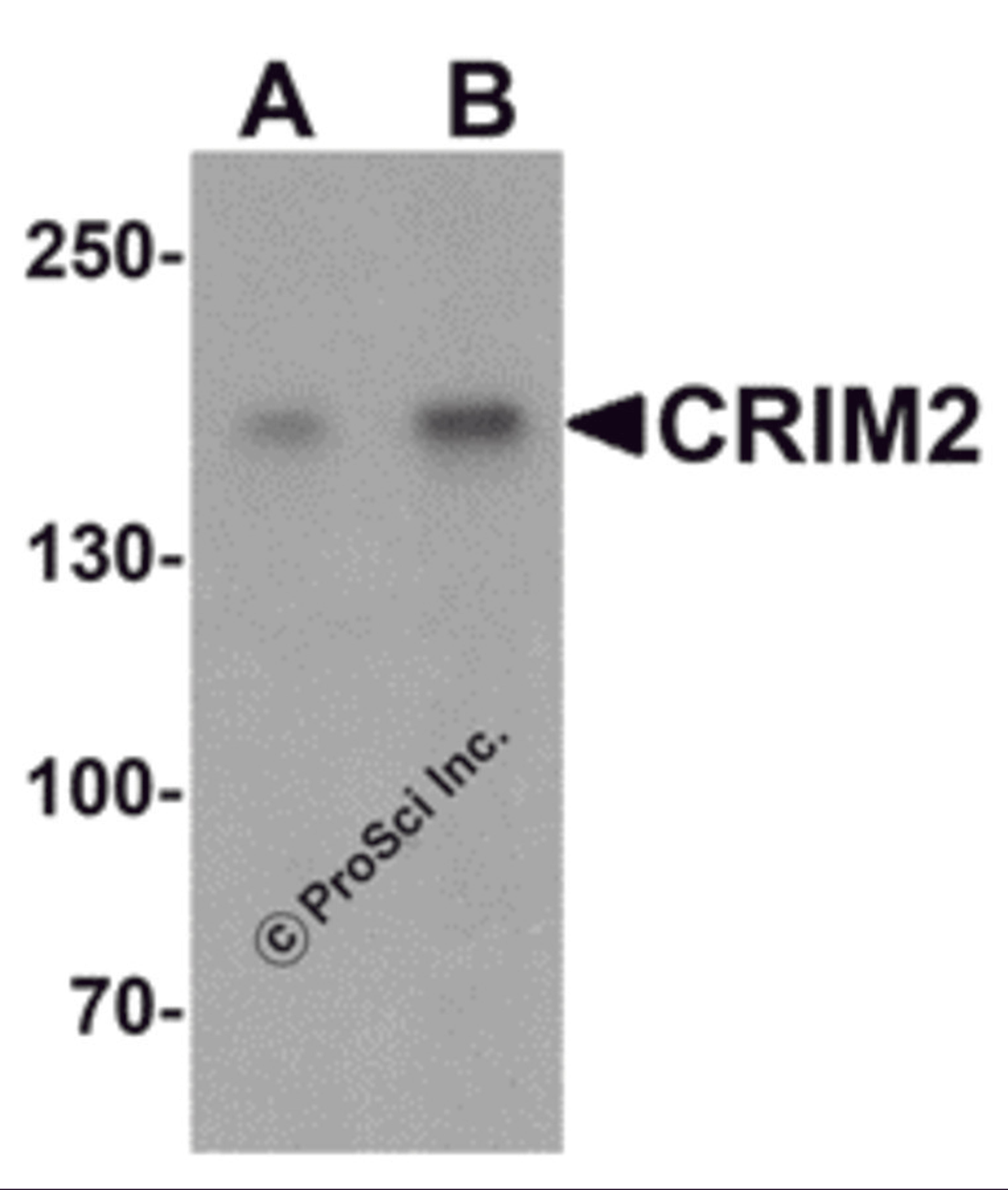 Western blot analysis of CRIM2 in Jurkat cell lysate with CRIM2 antibody at (A) 1 and (B) 2 μg/mL.