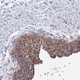 Immunohistochemistry: ANKRD34C Antibody [NBP2-33442] - Immunohistochemical staining of human urinary bladder shows strong granular cytoplasmic positivity in urothelial cells.