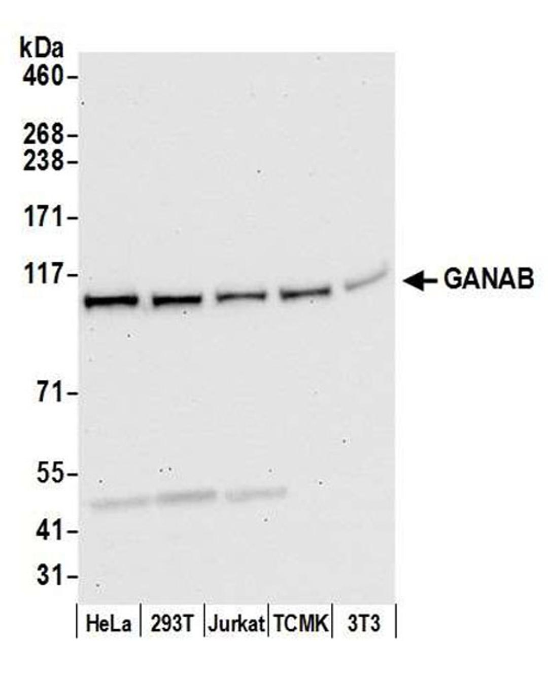 Detection of human and mouse GANAB by WB.