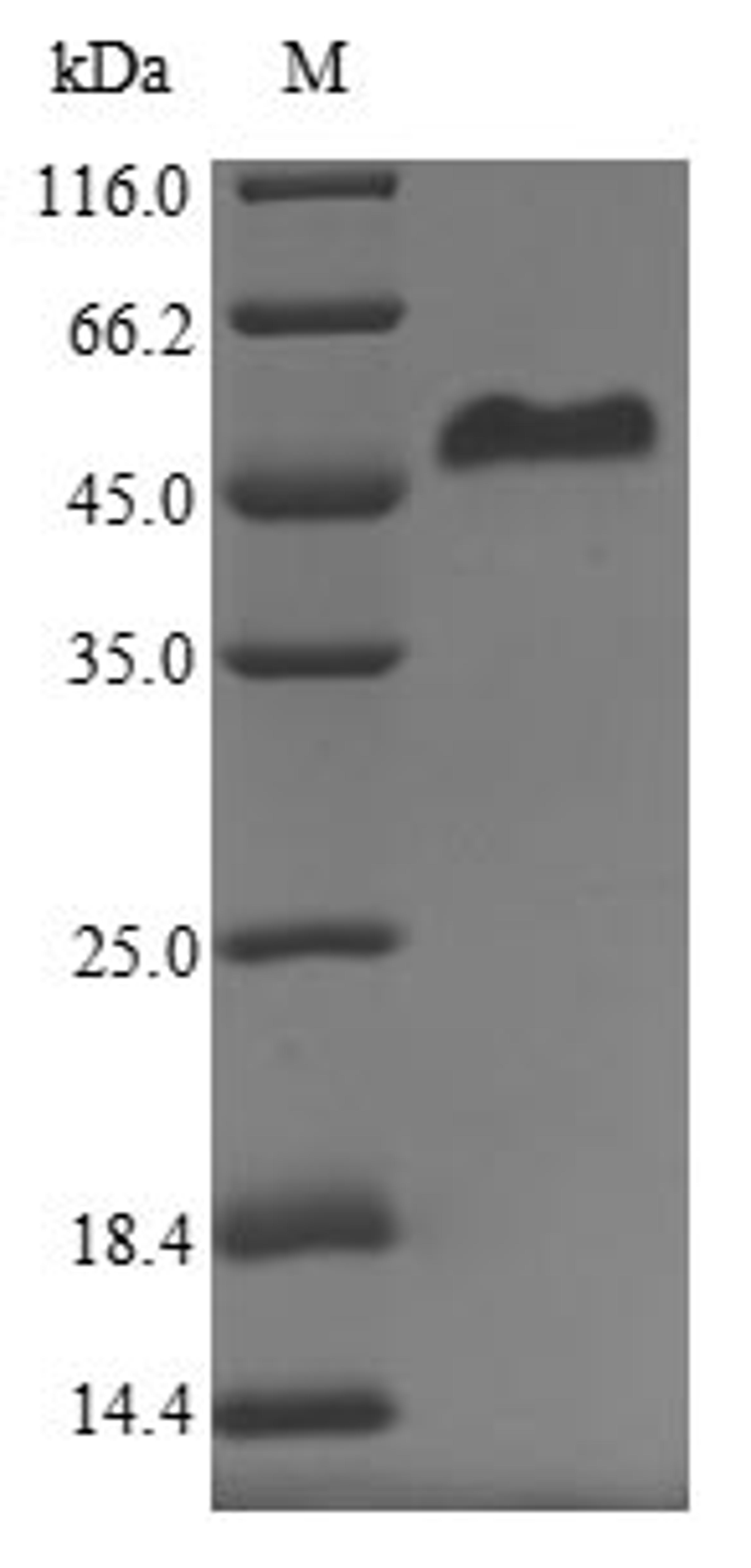 (Tris-Glycine gel) Discontinuous SDS-PAGE (reduced) with 5% enrichment gel and 15% separation gel.