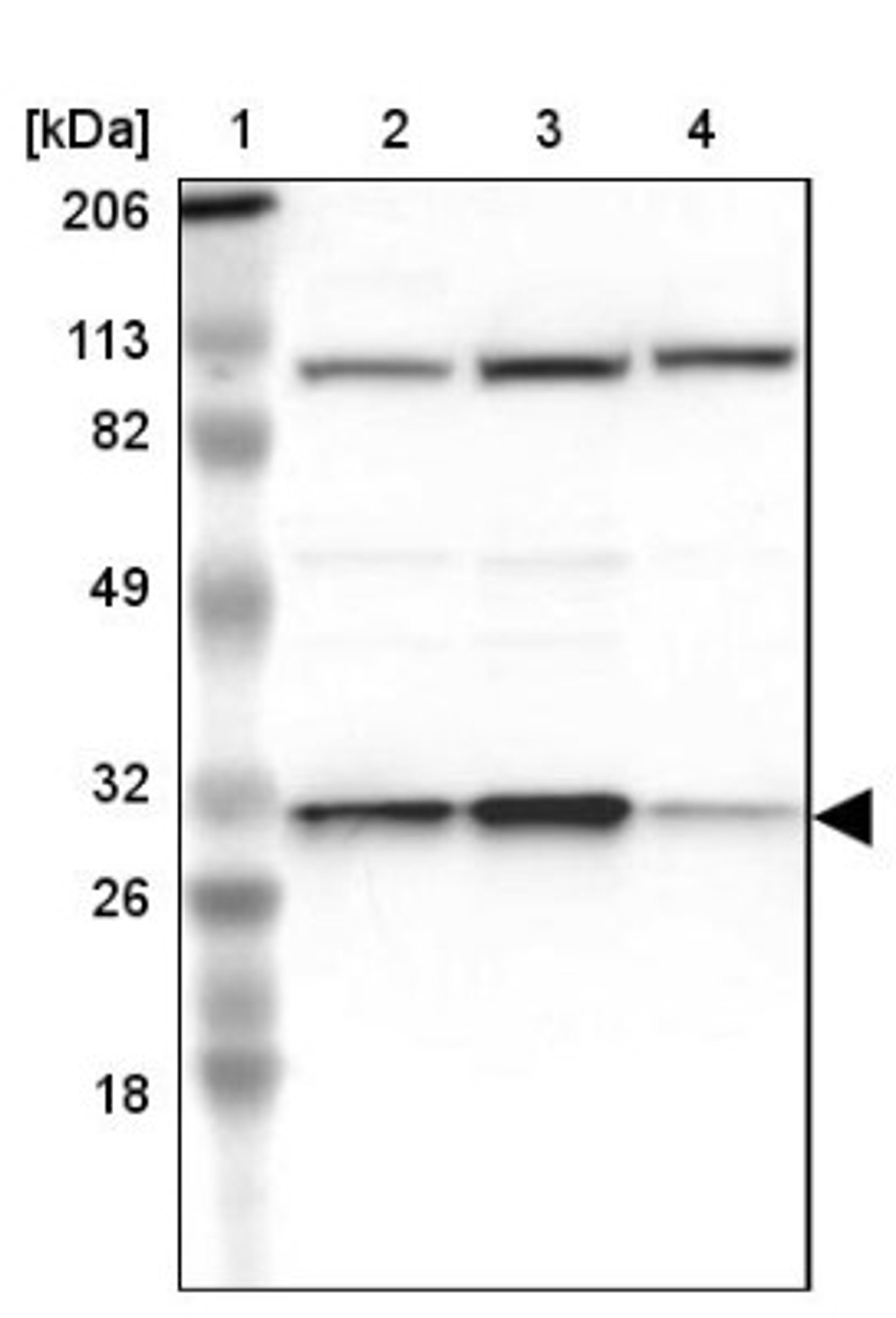 Western Blot: CYC1 Antibody [NBP1-86872] - Lane 1: Marker [kDa] 206, 113, 82, 49, 32, 26, 18<br/>Lane 2: Human cell line RT-4<br/>Lane 3: Human cell line U-251MG sp<br/>Lane 4: Human cell line A-431