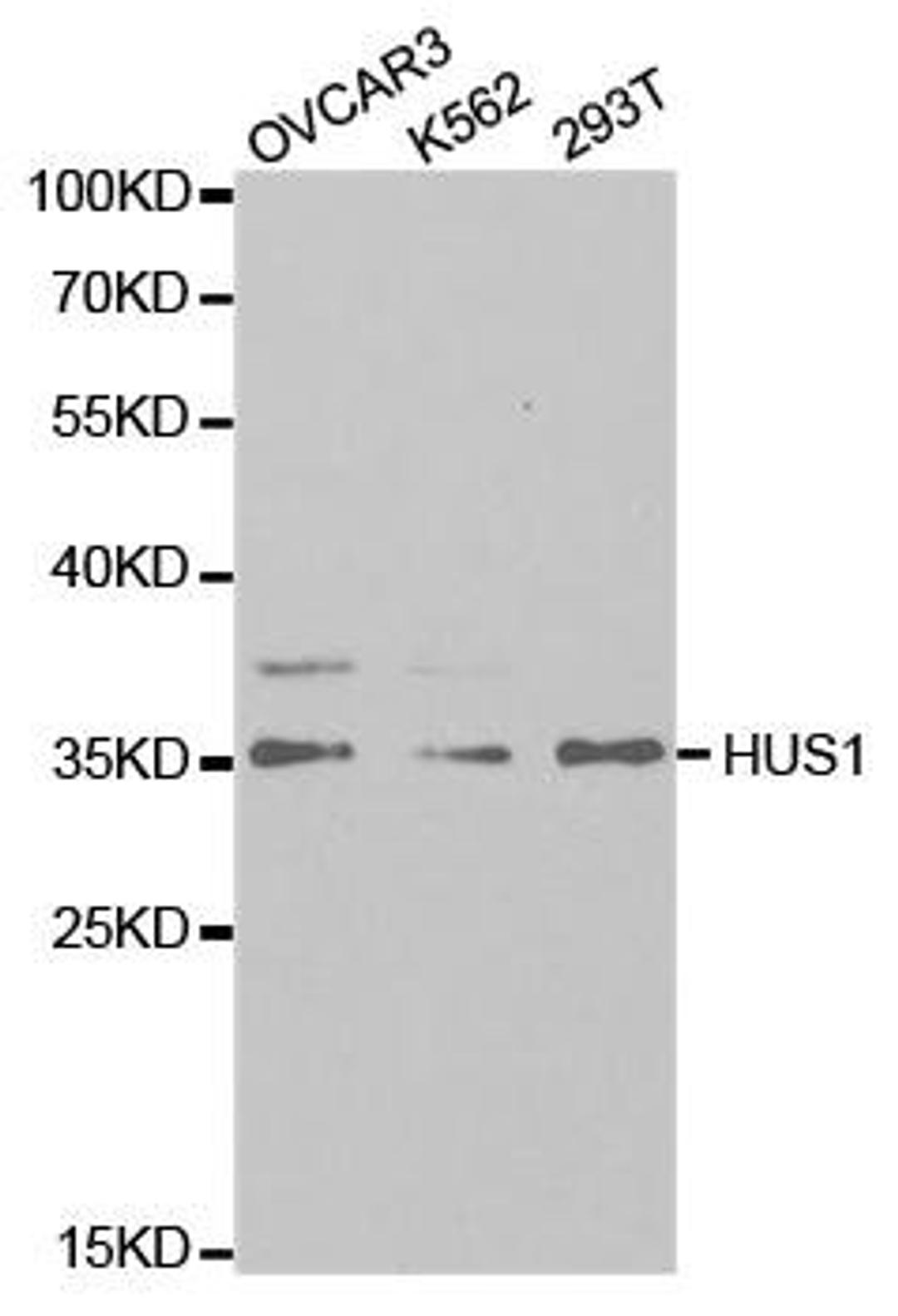 Western blot analysis of extracts of various cell lines using HUS1 antibody