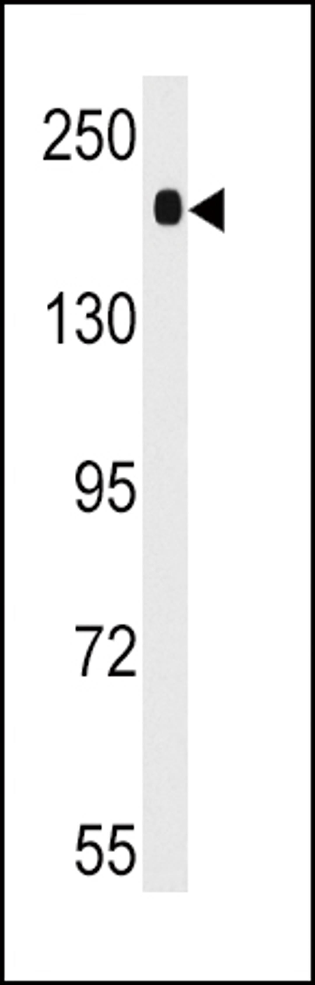 Western blot analysis of anti-ACE Antibody in mouse lung tissue lysates (35ug/lane)