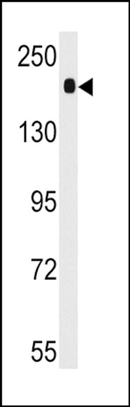 Western blot analysis of anti-ACE Antibody in mouse lung tissue lysates (35ug/lane)