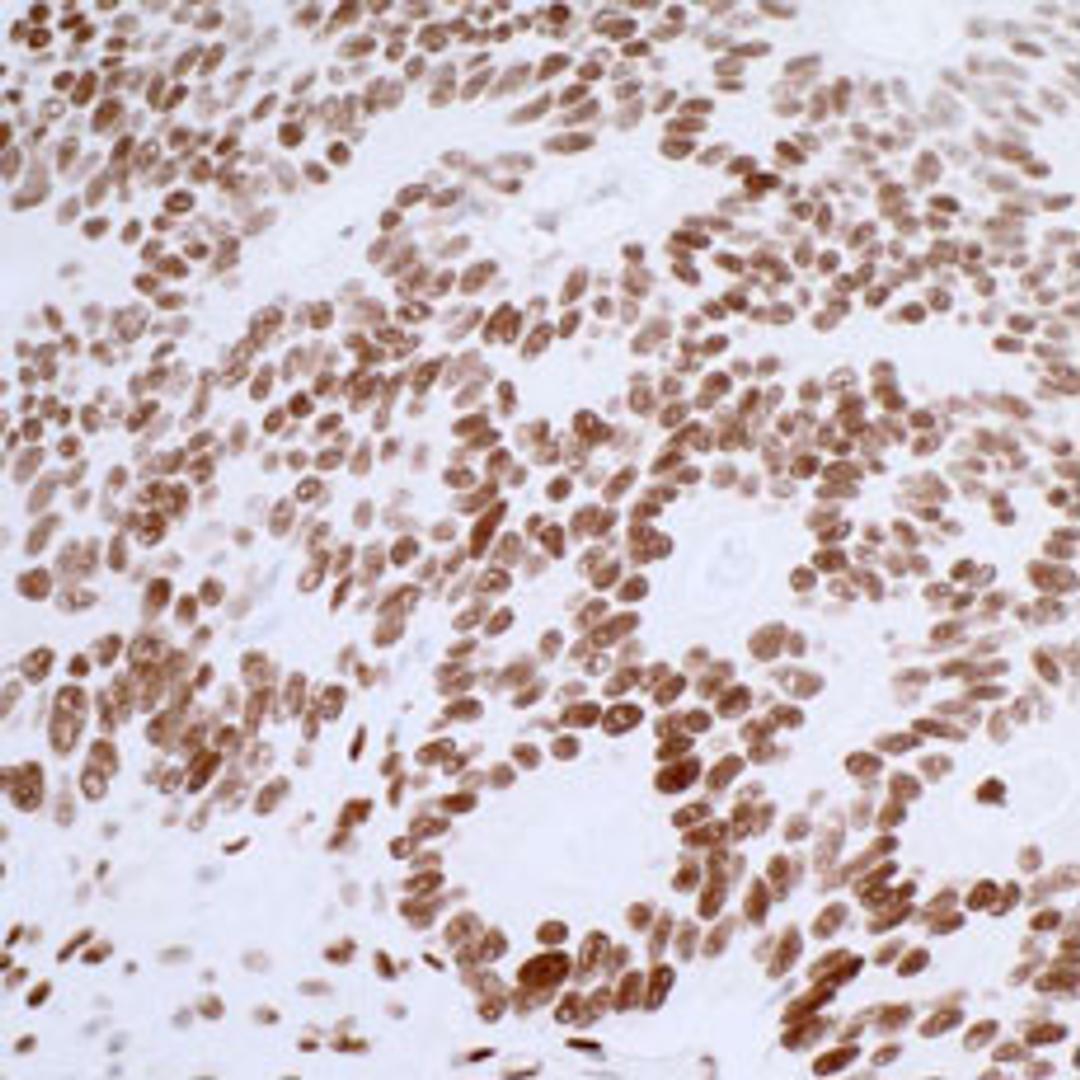 Detection of human 53BP1 by immunohistochemistry.