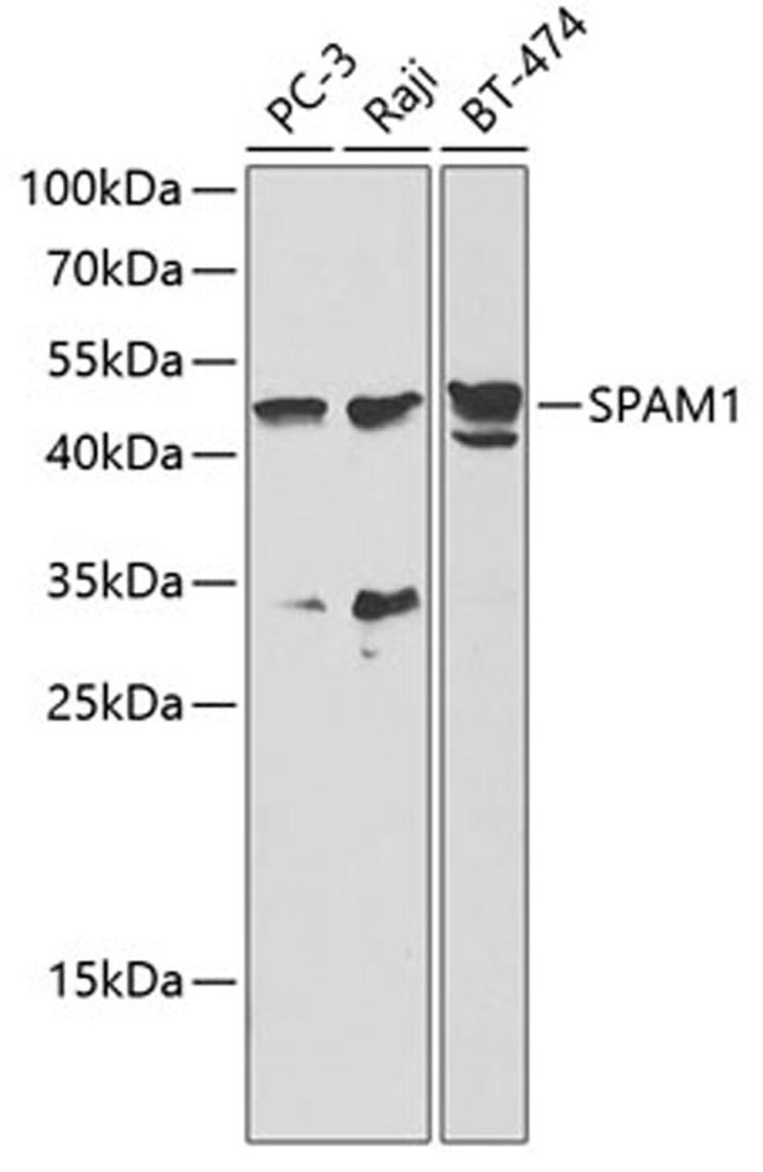 Western blot - SPAM1 antibody (A2120)