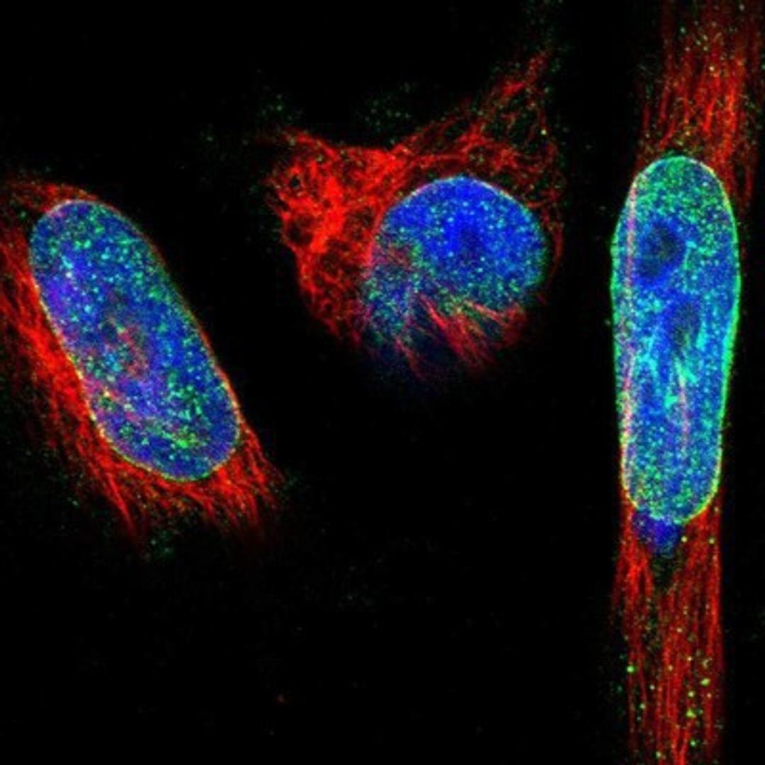 Immunocytochemistry/Immunofluorescence: SYNE1 Antibody [NBP1-89349] - Staining of human cell line U-251MG shows positivity in nucleus but not nucleoli & nuclear membrane.