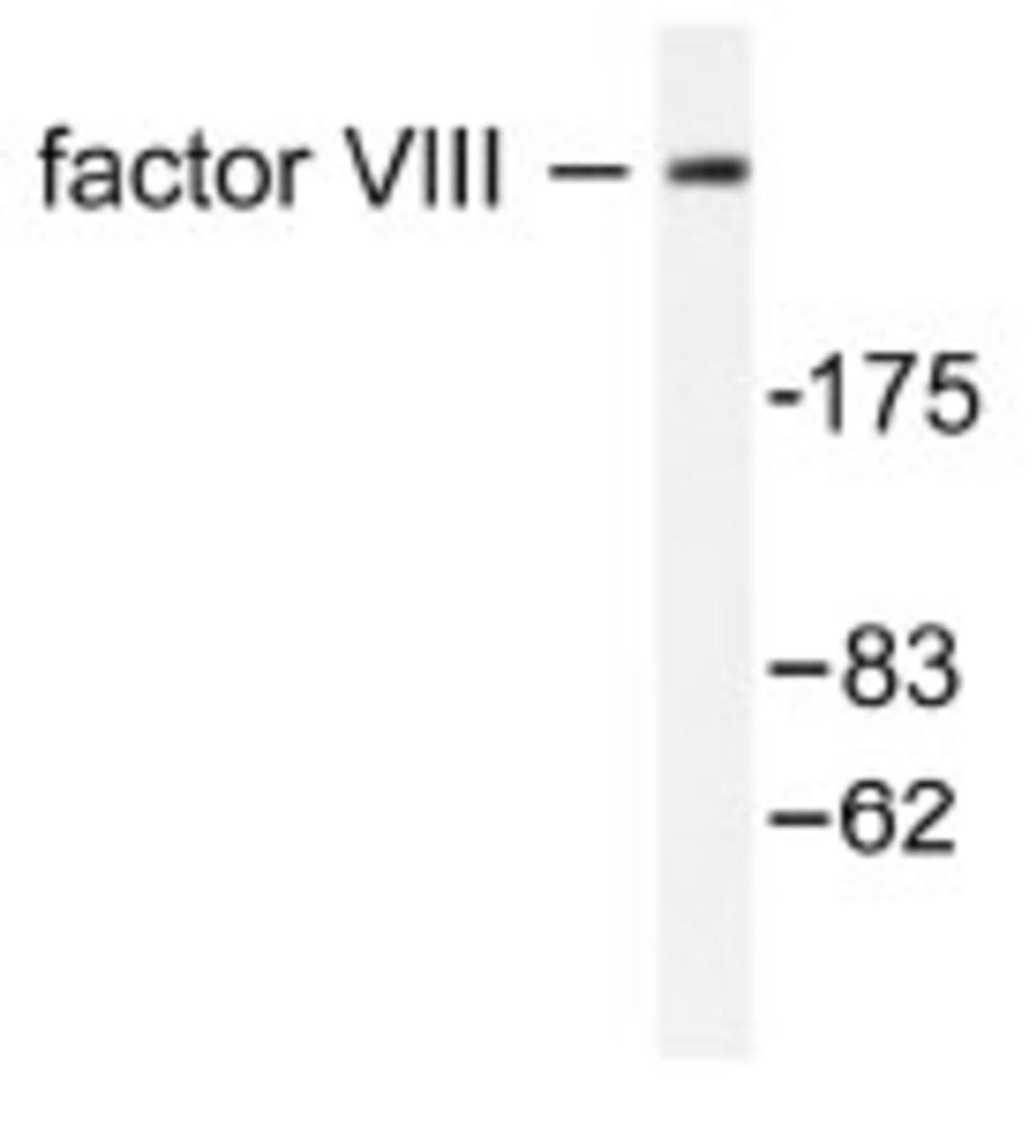 Western Blot: Factor VIII antibody (S2194) [NB100-91761] - in extracts from HuvEc cells.