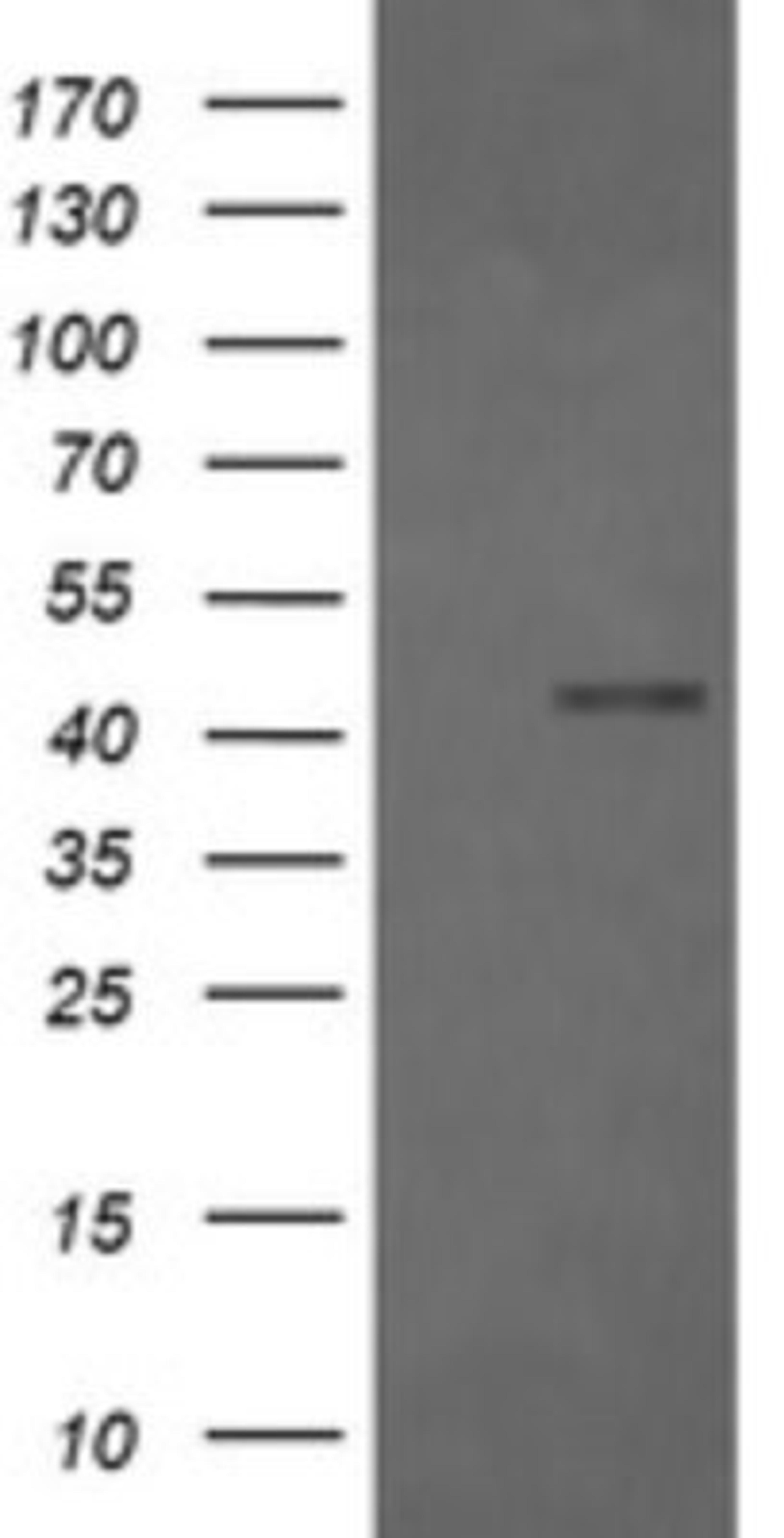 Western Blot: Fc gamma RI/CD64 Antibody (1A8) [NBP2-45625] - Analysis of HEK293T cells were transfected with the pCMV6-ENTRY control (Left lane) or pCMV6-ENTRY Fc gamma RI/CD64.