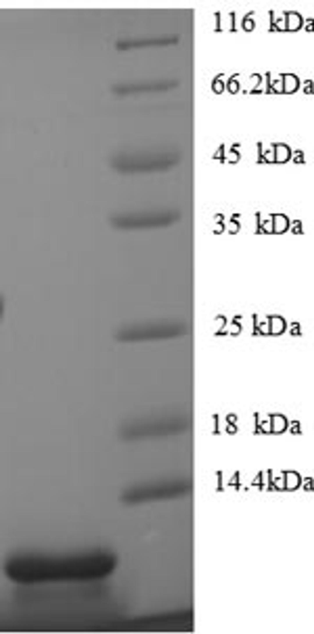(Tris-Glycine gel) Discontinuous SDS-PAGE (reduced) with 5% enrichment gel and 15% separation gel.