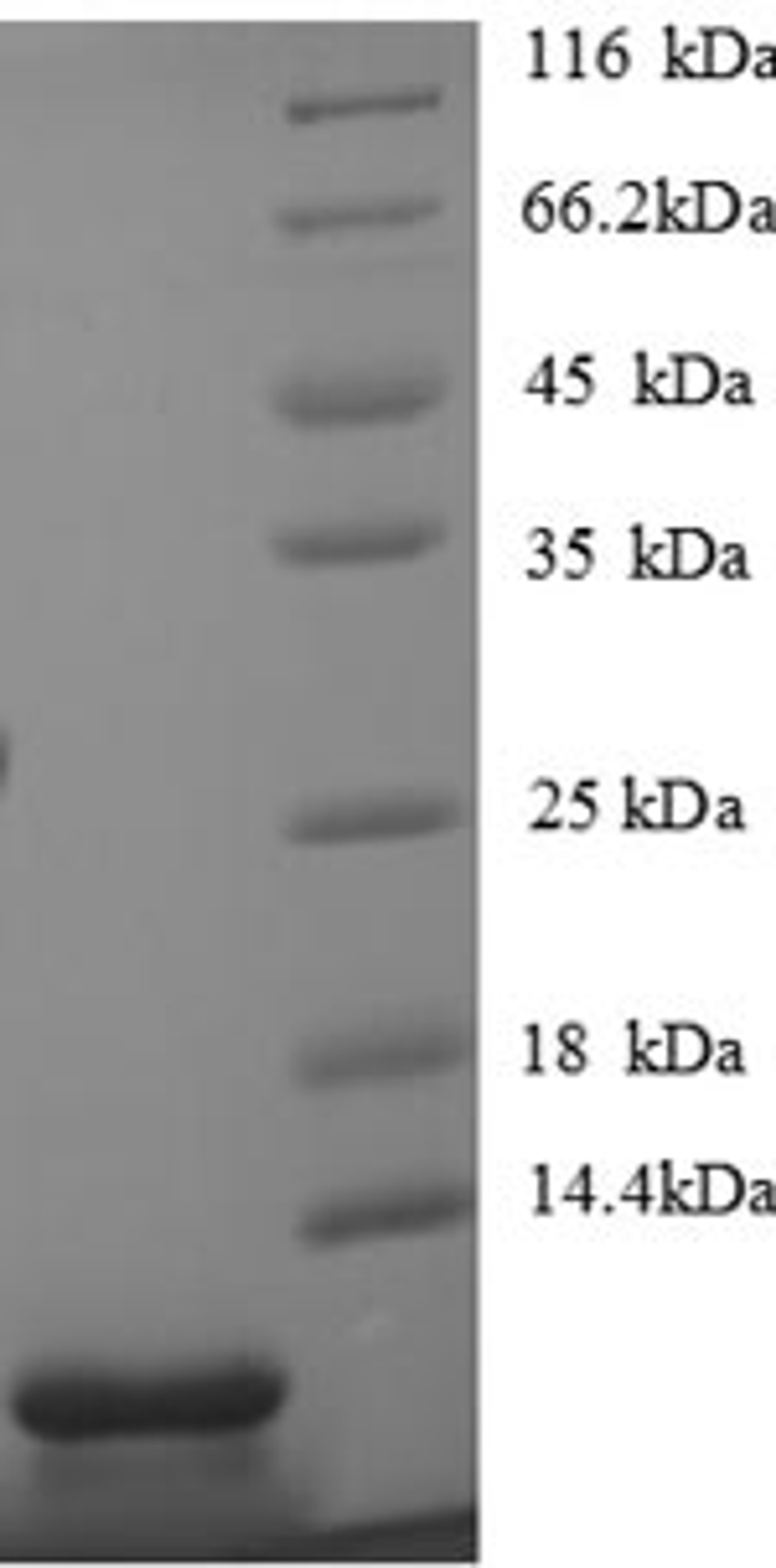 (Tris-Glycine gel) Discontinuous SDS-PAGE (reduced) with 5% enrichment gel and 15% separation gel.