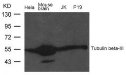 Western blot analysis of extract from Mouse brain tissue, HeLa, JK and P19 cells using Tubulin beta-III Antibody.