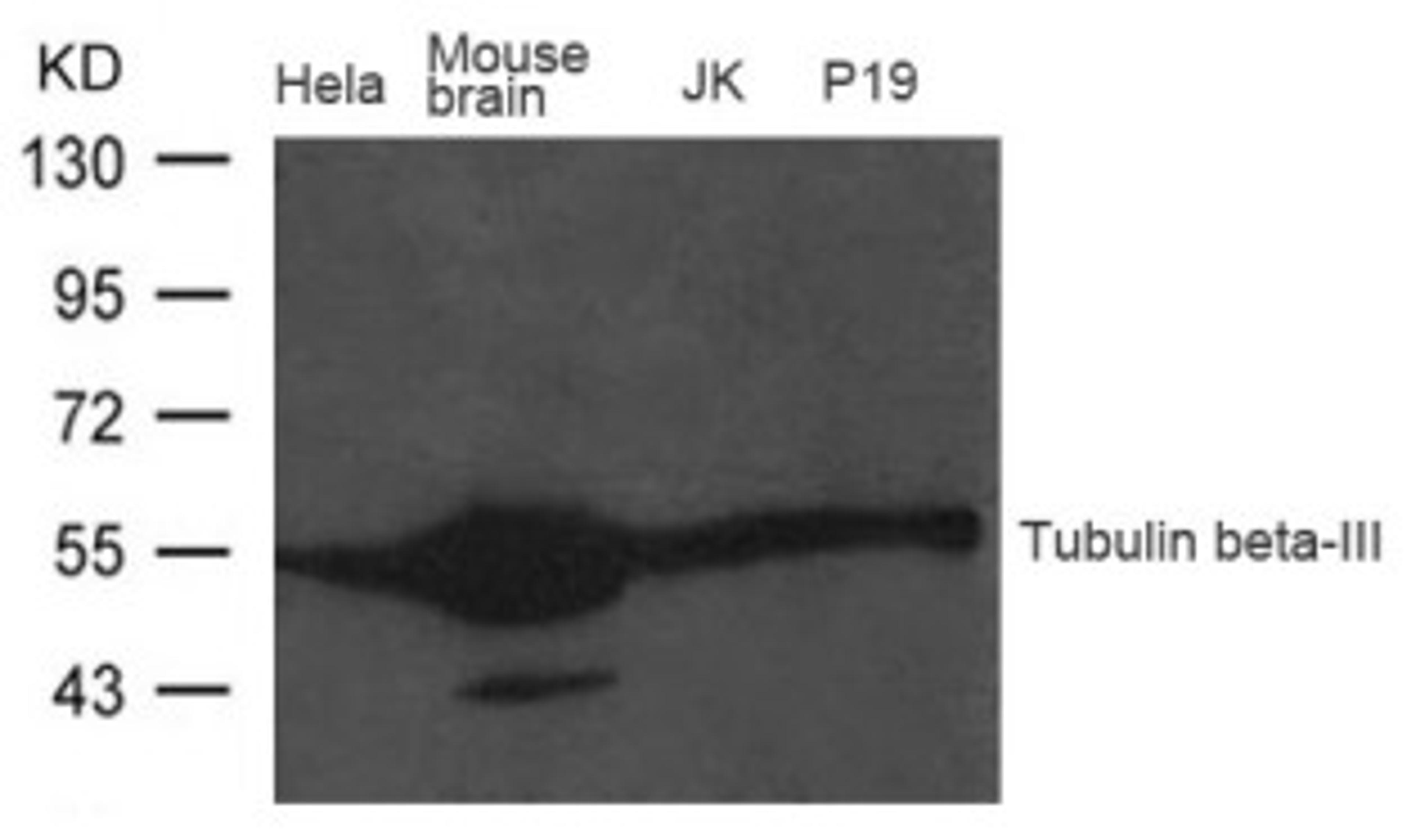 Western blot analysis of extract from Mouse brain tissue, HeLa, JK and P19 cells using Tubulin beta-III Antibody.