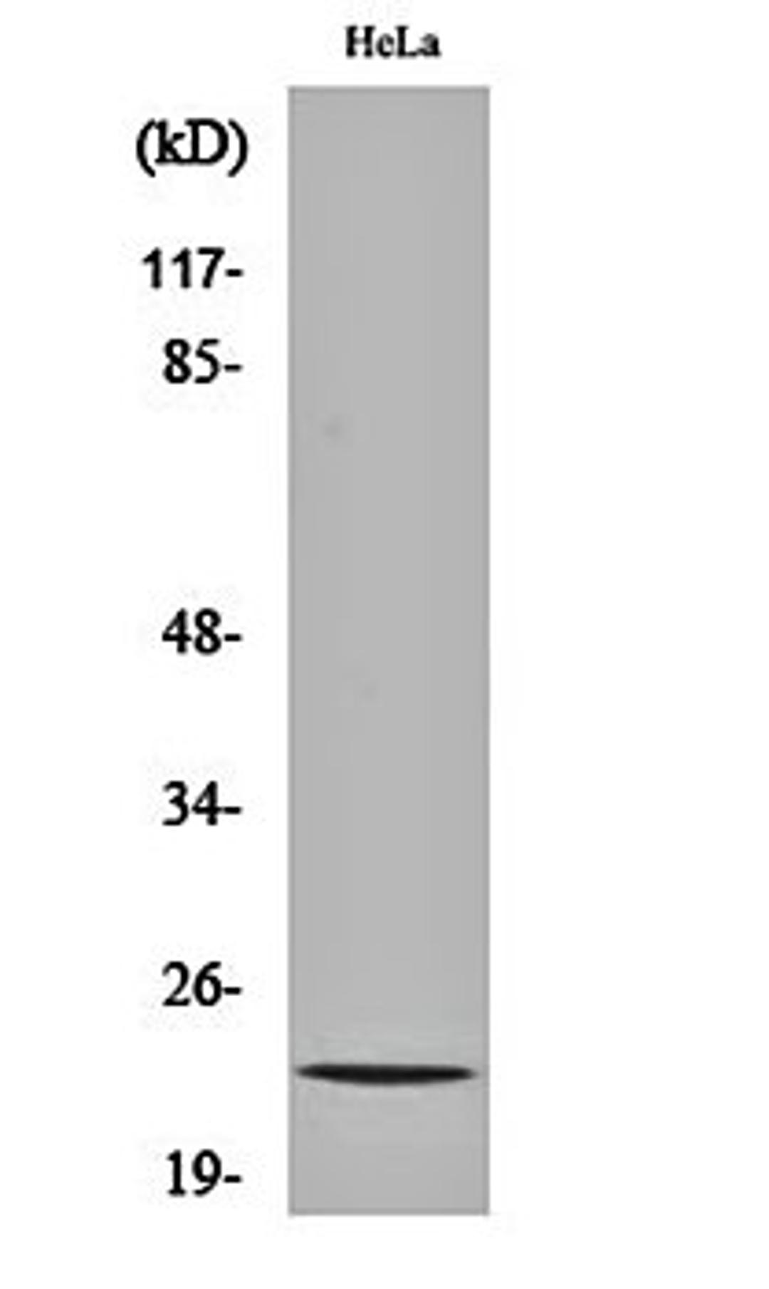 Western blot analysis of Hela cell lysates using Myp antibody