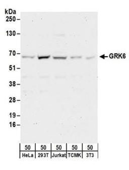 Detection of human and mouse GRK6 by western blot.