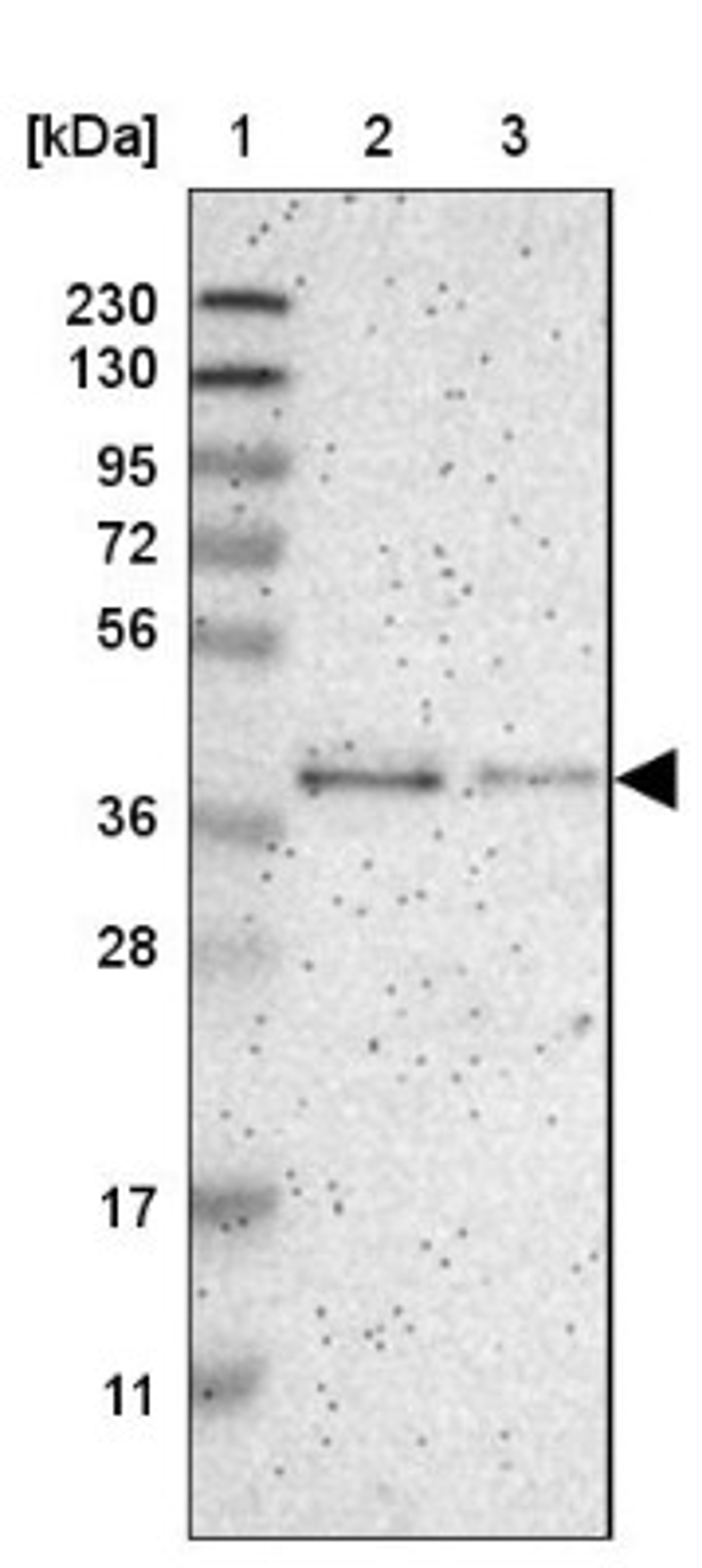 Western Blot: GMPPB Antibody [NBP1-81366] - Lane 1: Marker [kDa] 230, 130, 95, 72, 56, 36, 28, 17, 11<br/>Lane 2: Human cell line RT-4<br/>Lane 3: Human cell line U-251MG sp