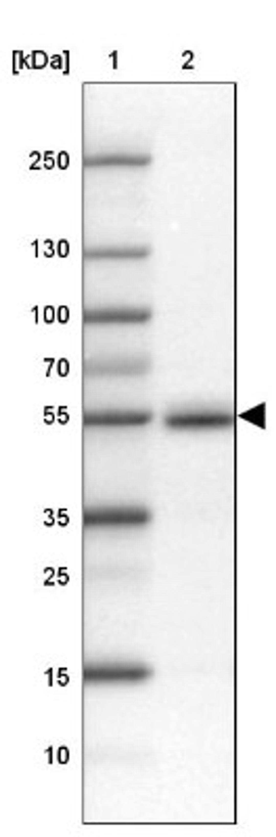 Western Blot: FAM149B1 Antibody [NBP1-81452] - Lane 1: Marker [kDa] 250, 130, 100, 70, 55, 35, 25, 15, 10<br/>Lane 2: Testis