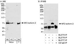 Detection of Isoform 2 of human NF2 by western blot and immunoprecipitation.