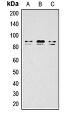 Western blot analysis of HeLa LPS-treated (Lane 1), mouse brain (Lane 2), rat brain (Lane 3) whole cell lysates using IKK alpha/beta (phospho-S176/177) antibody