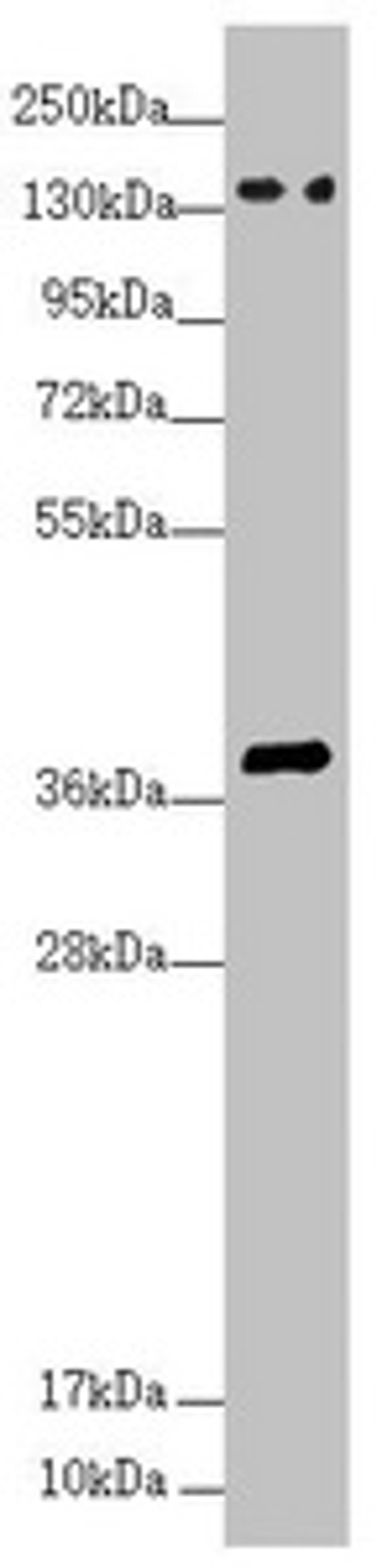 Western blot. All lanes: SFI1 antibody at 4.26 ug/ml + HepG2 whole cell lysate. Secondary. Goat polyclonal to rabbit IgG at 1/10000 dilution. Predicted band size: 148, 144, 139, 122, 118, 142, 137 kDa. Observed band size: 148, 38 kDa. 