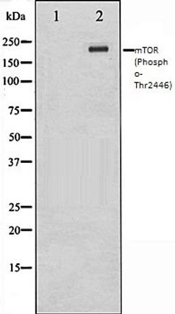 Western blot analysis of NIH-3T3 whole cell lysates using mTOR (Phospho-Thr2446) antibody, The lane on the left is treated with the antigen-specific peptide.