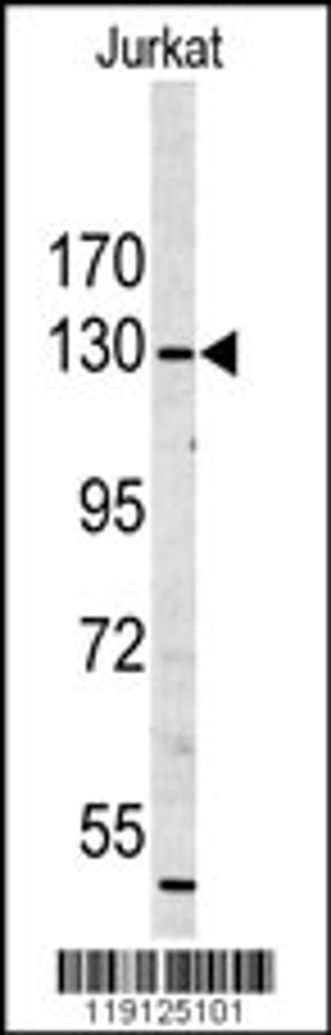 Western blot analysis of in Jurkat cell line lysates (35ug/lane)