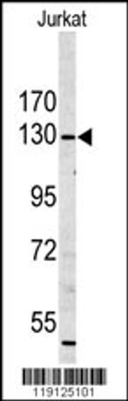 Western blot analysis of in Jurkat cell line lysates (35ug/lane)