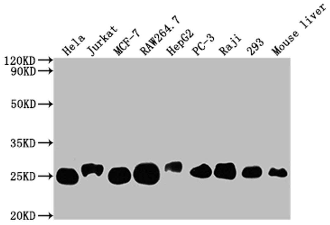 Western Blot. Positive WB detected in: Hela whole cell lysate, Jurkat whole cell lysate, MCF-7 whole cell lysate, RAW264.7 whole cell lysate, HepG2 whole cell lysate, PC-3 whole cell lysate, Raji whole cell lysate, 293 whole cell lysate, Mouse liver tissue. All lanes: TPT1 antibody at 1:2000. Secondary. Goat polyclonal to rabbit IgG at 1/50000 dilution. Predicted band size: 20, 16 kDa. Observed band size: 25 kDa. 