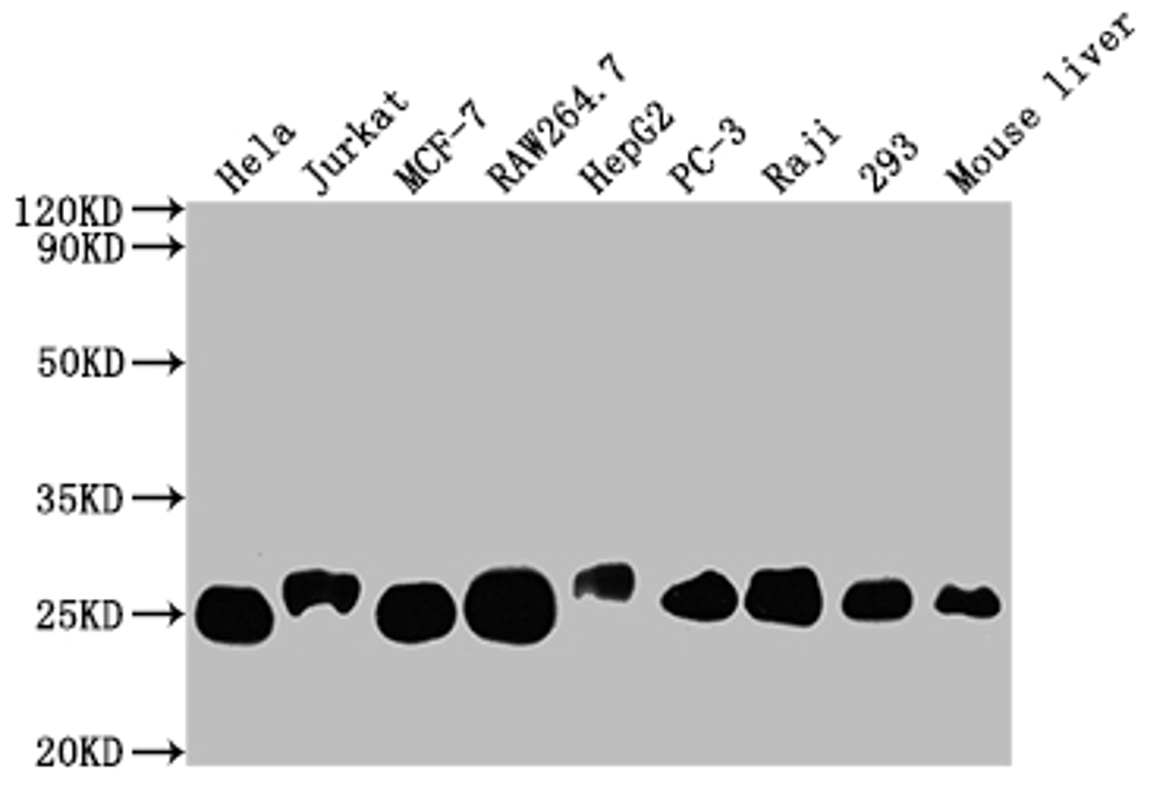 Western Blot. Positive WB detected in: Hela whole cell lysate, Jurkat whole cell lysate, MCF-7 whole cell lysate, RAW264.7 whole cell lysate, HepG2 whole cell lysate, PC-3 whole cell lysate, Raji whole cell lysate, 293 whole cell lysate, Mouse liver tissue. All lanes: TPT1 antibody at 1:2000. Secondary. Goat polyclonal to rabbit IgG at 1/50000 dilution. Predicted band size: 20, 16 kDa. Observed band size: 25 kDa. 