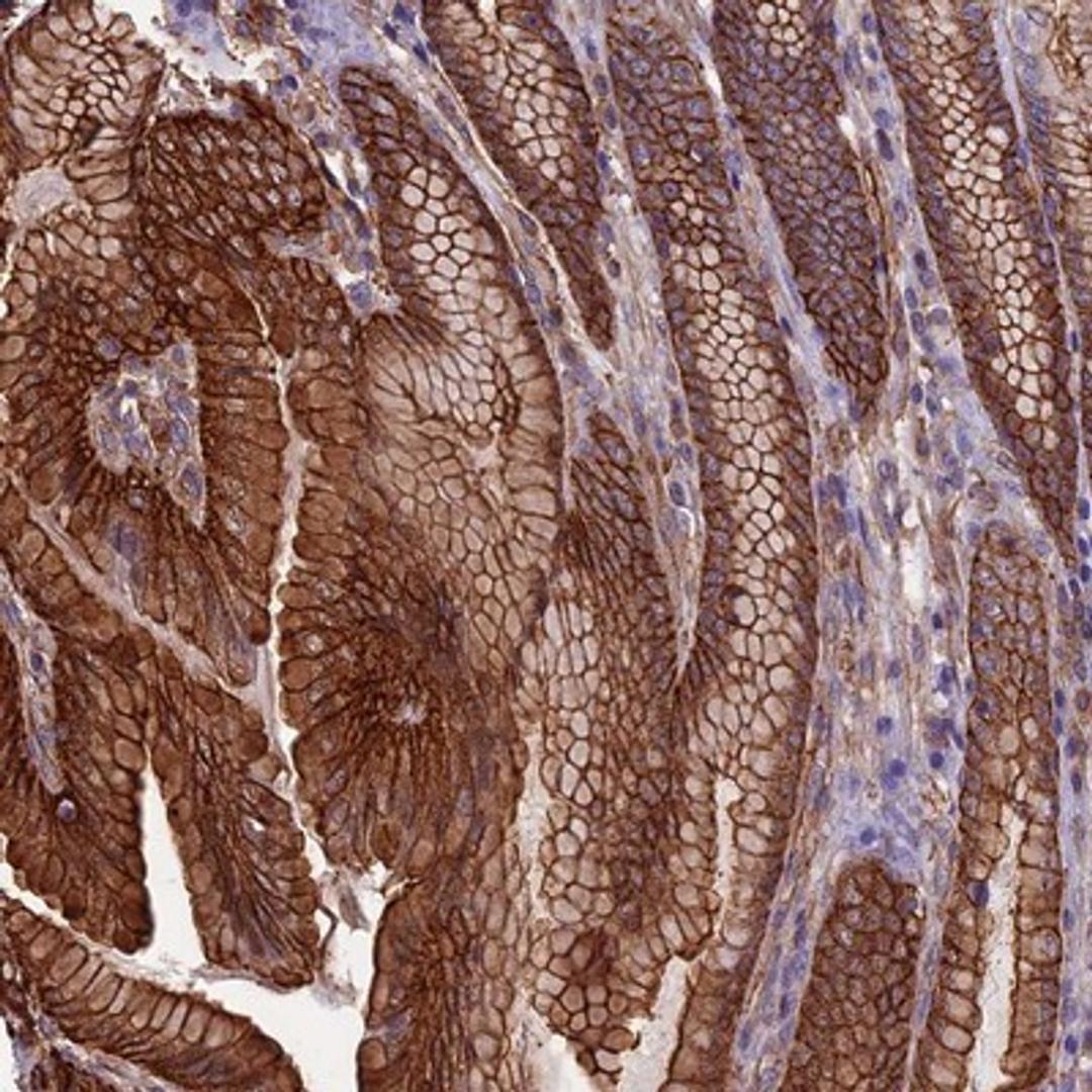 Immunohistochemistry-Paraffin: ANGPTL2 Antibody [NBP1-88997] - Staining of human stomach, upper shows strong membranous and cytoplasmic positivity in glandular cells.