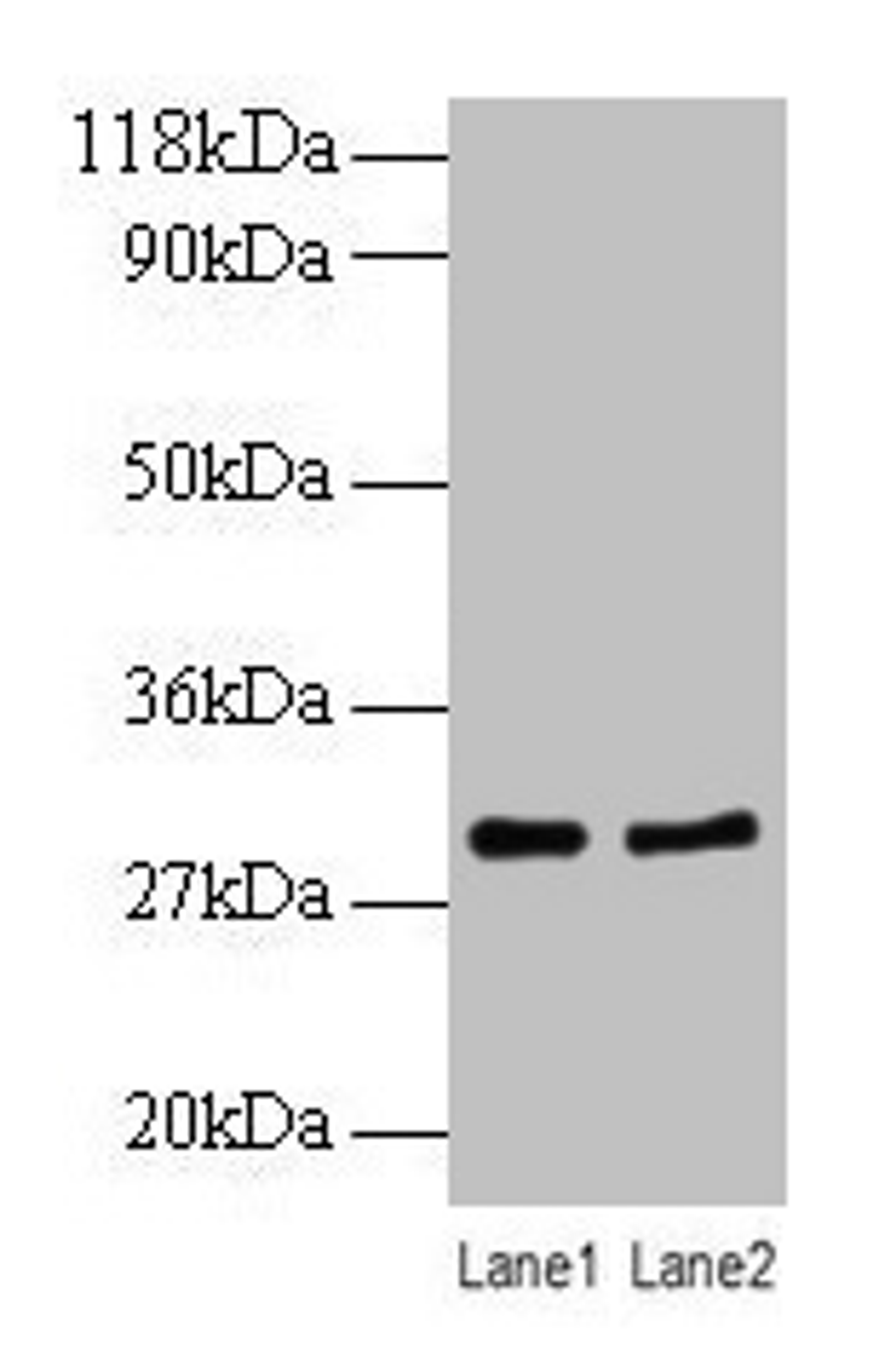 Western blot. All lanes: RPL8 antibody at 2µg/ml. Lane 1: EC109 whole cell lysate. Lane 2: 293T whole cell lysate. Secondary. Goat polyclonal to rabbit IgG at 1/10000 dilution. Predicted band size: 29 kDa. Observed band size: 29 kDa
