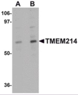 Western blot analysis of TMEM214 in A20 cell lysate with TMEM214 antibody at (A) 1 and (B) 2 &#956;g/mL.