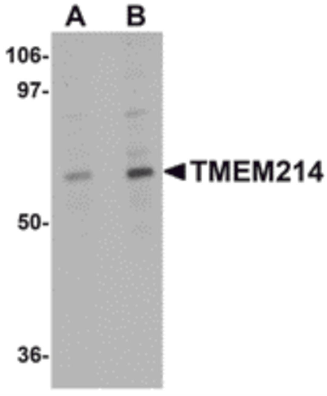Western blot analysis of TMEM214 in A20 cell lysate with TMEM214 antibody at (A) 1 and (B) 2 μg/mL.