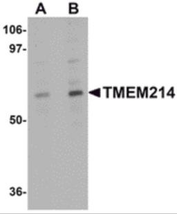 Western blot analysis of TMEM214 in A20 cell lysate with TMEM214 antibody at (A) 1 and (B) 2 μg/mL.