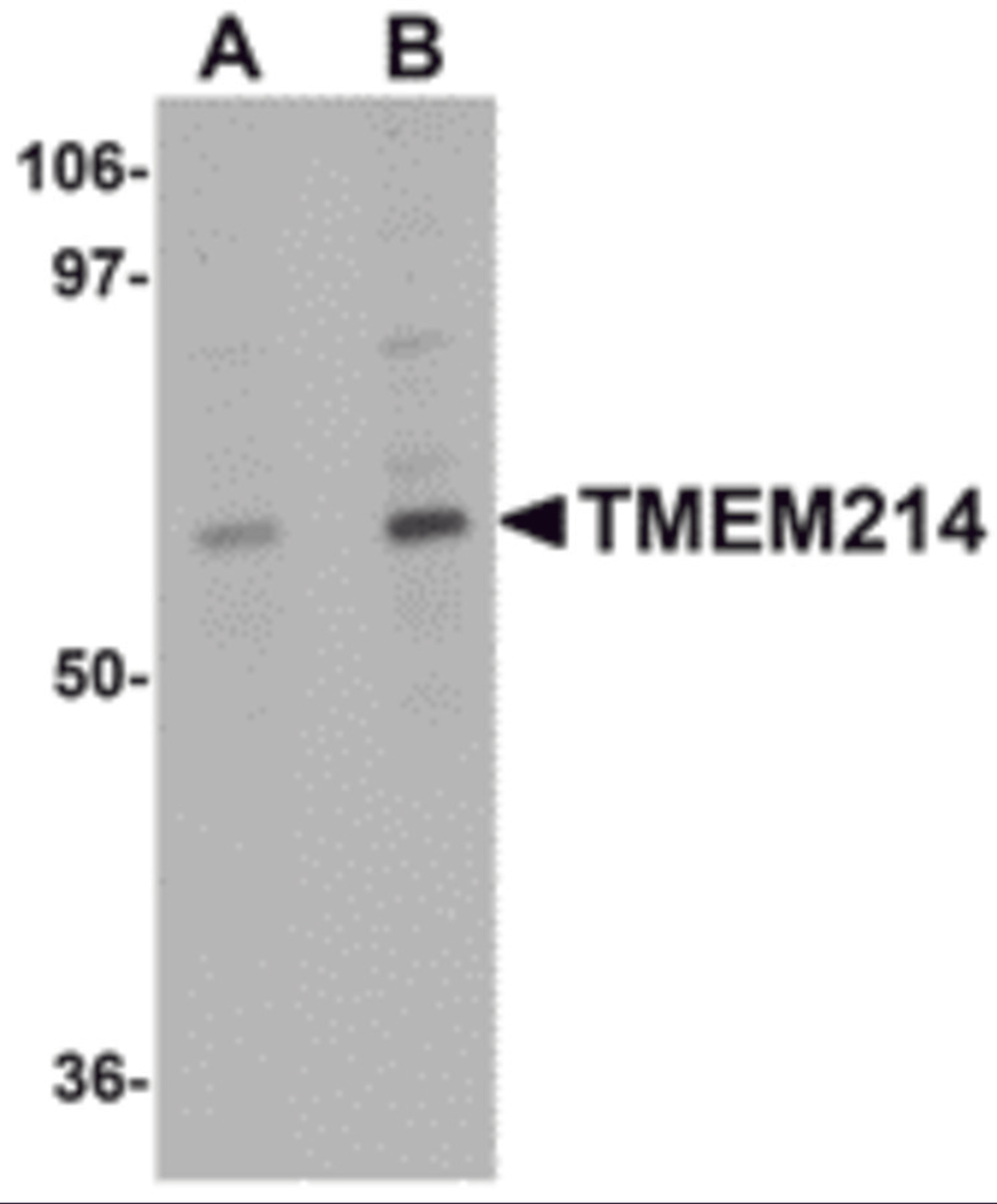 Western blot analysis of TMEM214 in A20 cell lysate with TMEM214 antibody at (A) 1 and (B) 2 μg/mL.