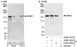 Detection of human and mouse MINK1 by western blot (h&m) and immunoprecipitation (h).