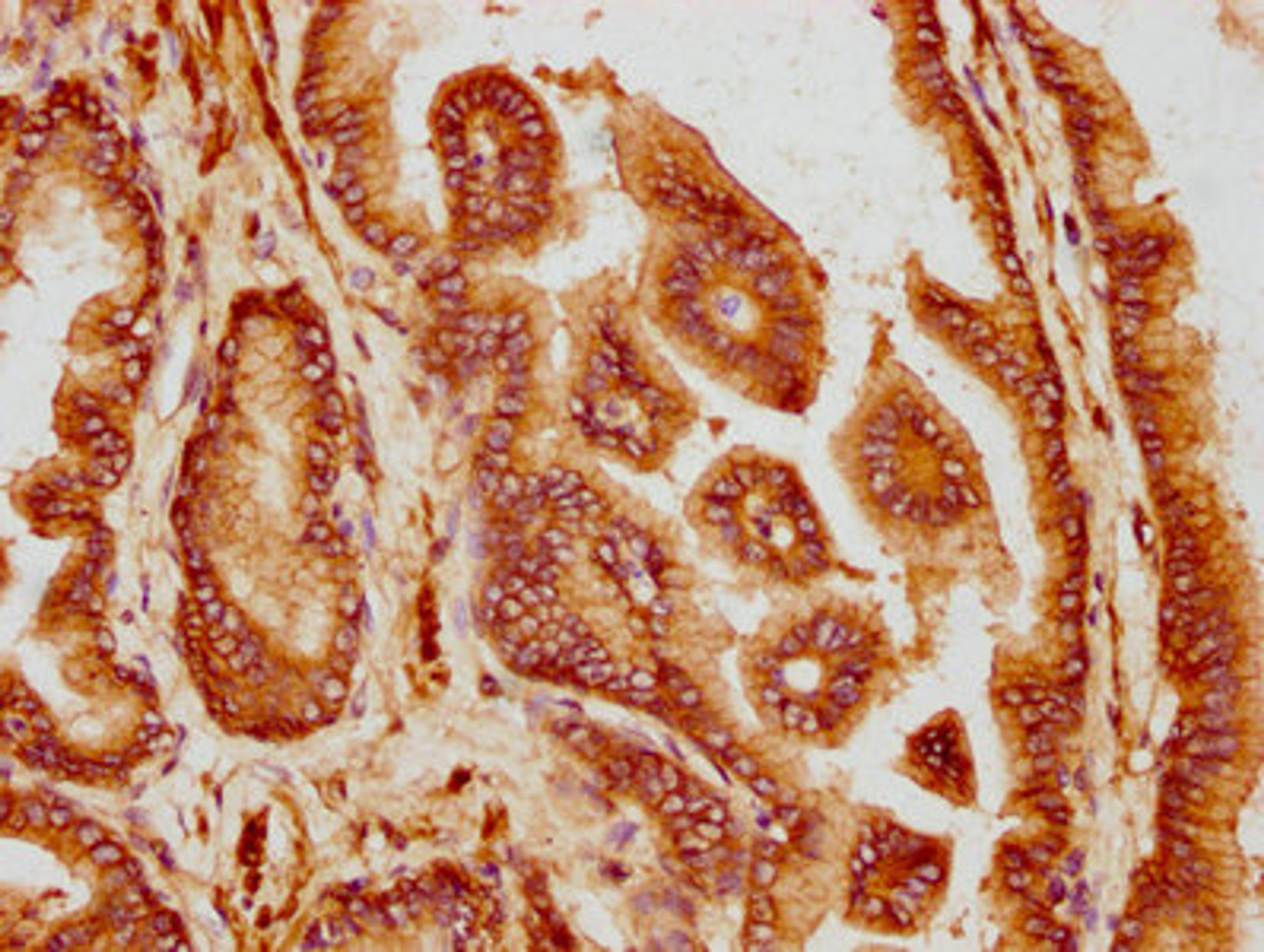 IHC image of CSB-PA004940LA01HU diluted at 1:300 and staining in paraffin-embedded human prostate tissue performed on a Leica BondTM system. After dewaxing and hydration, antigen retrieval was mediated by high pressure in a citrate buffer (pH 6.0). Section was blocked with 10% normal goat serum 30min at RT. Then primary antibody (1% BSA) was incubated at 4°C overnight. The primary is detected by a biotinylated secondary antibody and visualized using an HRP conjugated SP system.