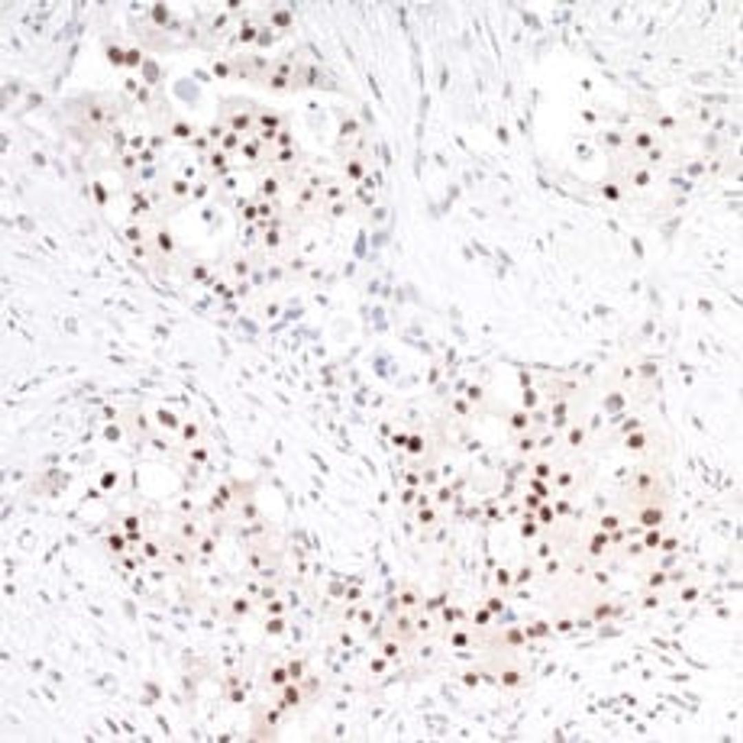 Detection of human TRAF4 by immunohistochemistry.