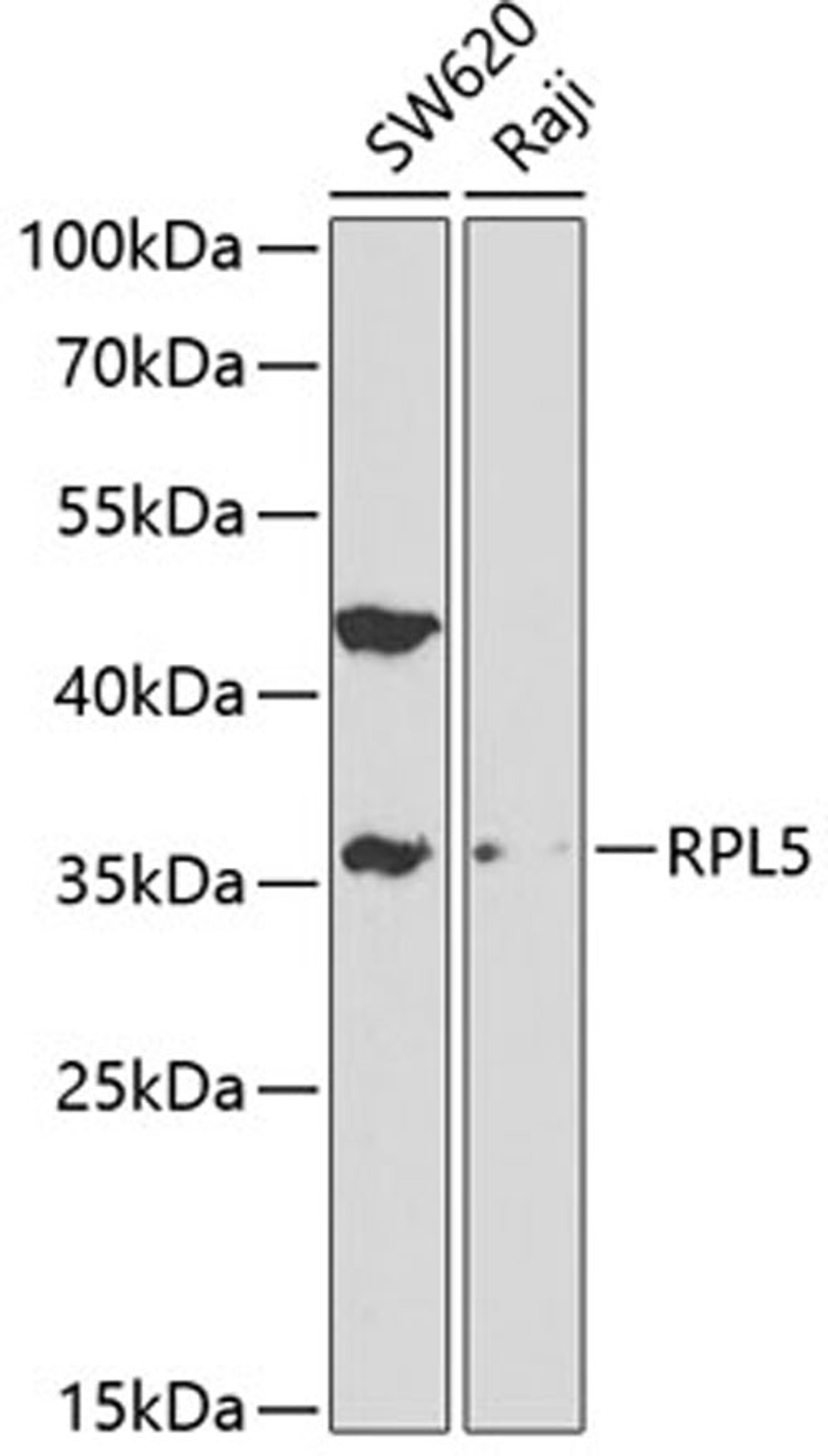 Western blot - RPL5 antibody (A1977)