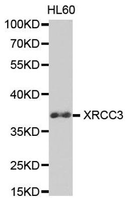 Western blot analysis of extracts of HL60 cell lines using XRCC3 antibody