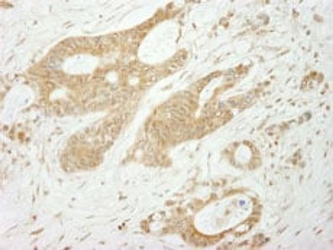 Detection of human Notch1immunohistochemistry.