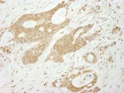 Detection of human Notch1immunohistochemistry.