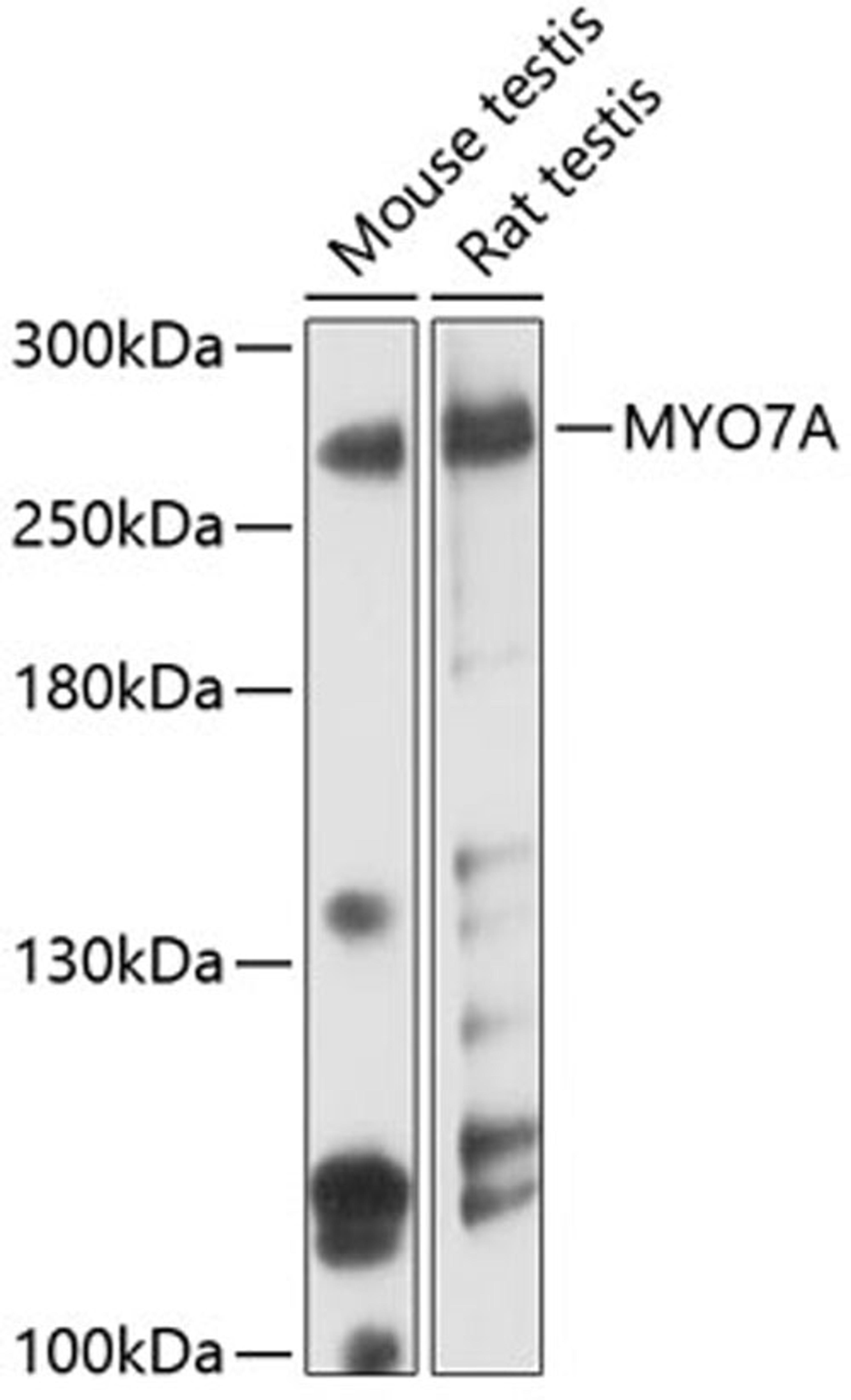 Western blot - MYO7A antibody (A1911)